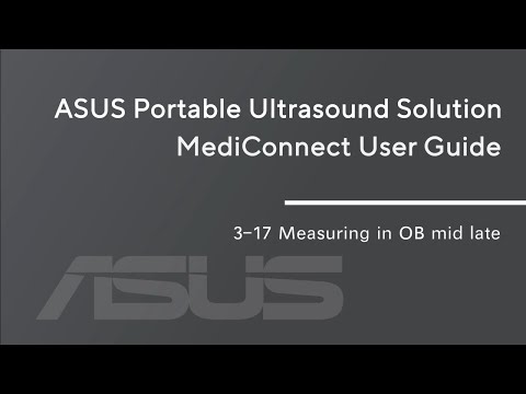 【ASUS Portable Ultrasound Solution LU700 Tutorial】3-17_Measuring in OB mid late